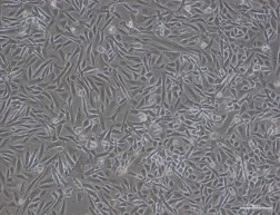CTI社 皮膚細胞（セボサイト、ファイブロブラスト、ケラチノサイト、メラノサイト等）