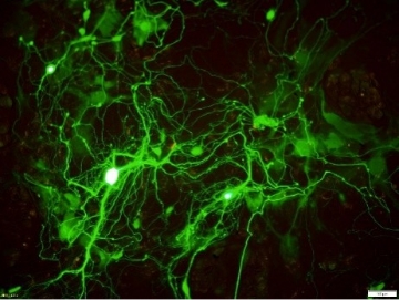 マウス新生児海馬神経細胞