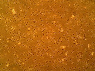 ヒト脳毛細血管内皮細胞